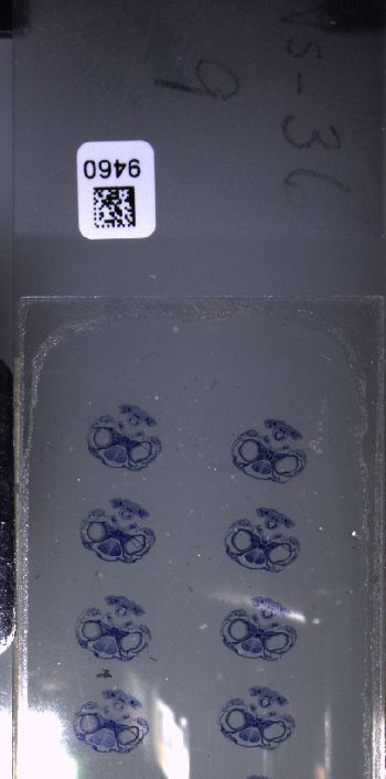 Media type: image; Special Collections 3102   shows specimen_part histological serial section;  Description: Whole slide scan, SC-3102, slide 9;